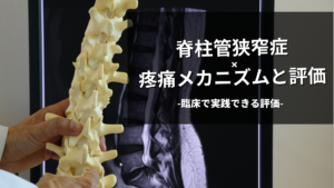 脊柱管狭窄症の疼痛メカニズムと評価