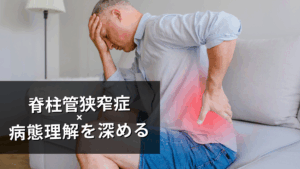 脊柱管狭窄症の病態
