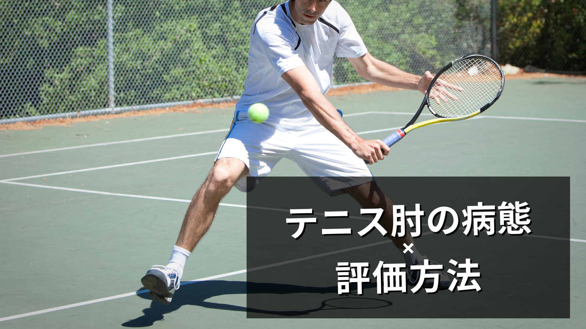 テニス肘の病態と評価