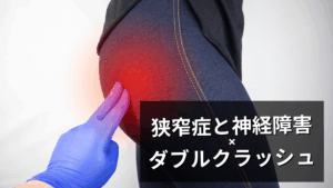 狭窄症で考えるダブルクラッシュシンドローム