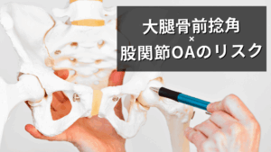 大腿骨前捻角と股関節OAのリスク