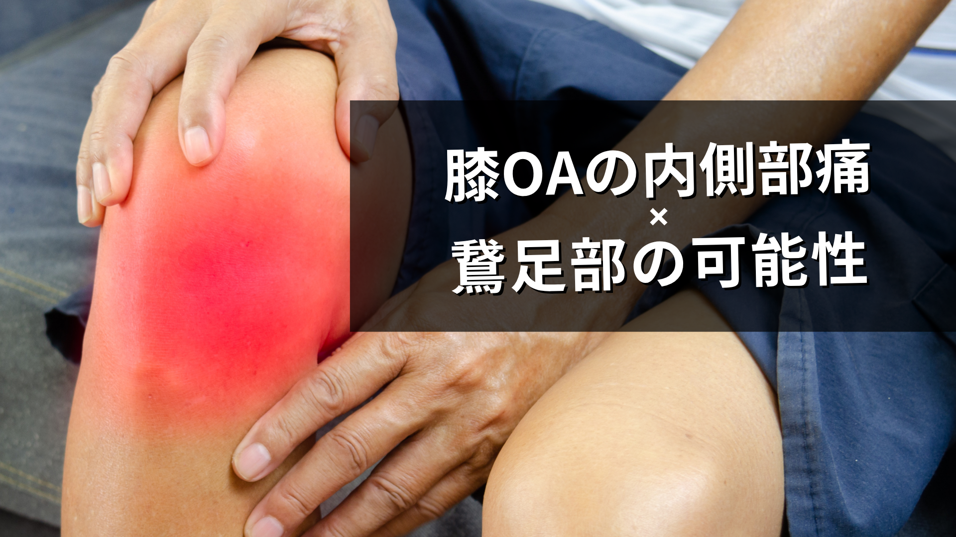 膝OA患者の膝関節内側の疼痛って？