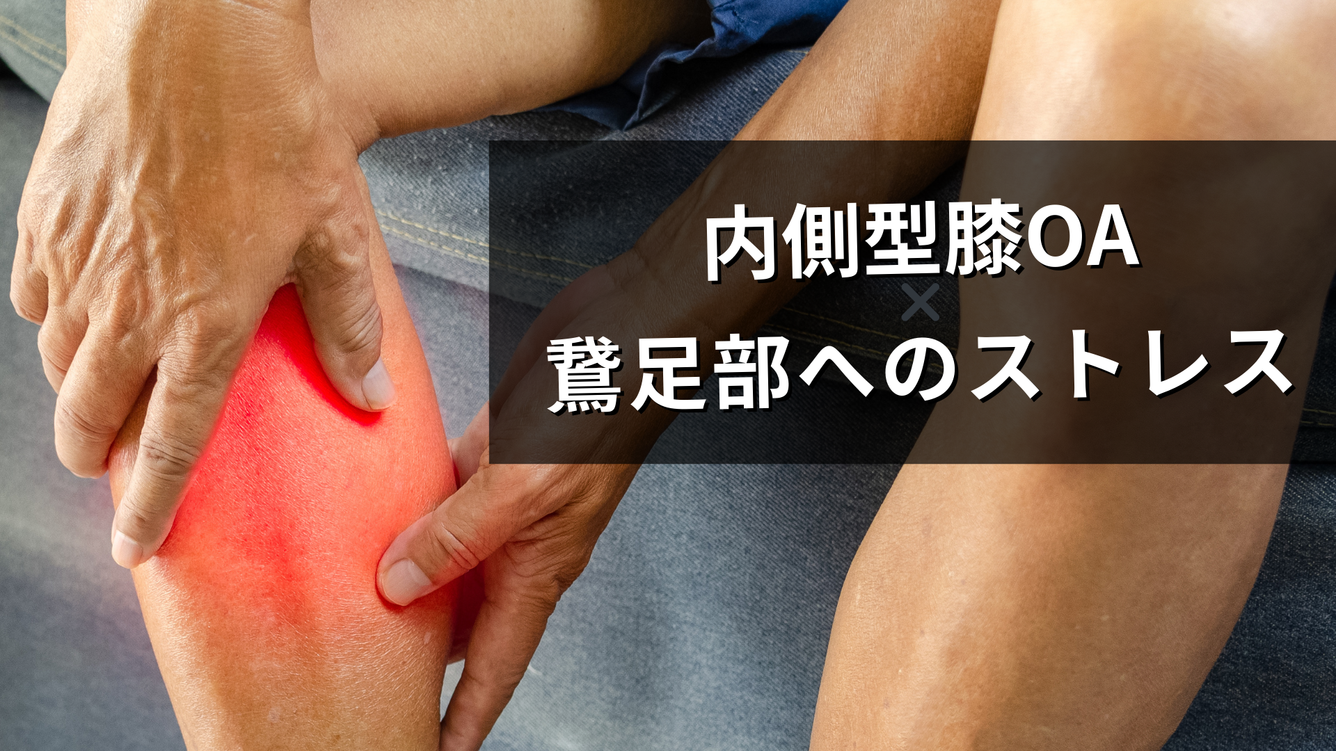 内側型膝OA患者の鵞足炎の本当の理由って？