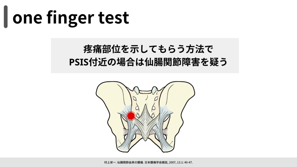 one finger test 疼痛部位を示してもらう。PSIS付近なら仙腸関節障害を疑う